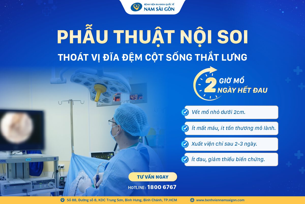 THOÁT ĐAU LƯNG, TÊ BÌ TAY CHÂN CHỈ 2 NGÀY SAU PHẪU THUẬT NỘI SOI ĐIỀU TRỊ THOÁT VỊ ĐĨA ĐỆM