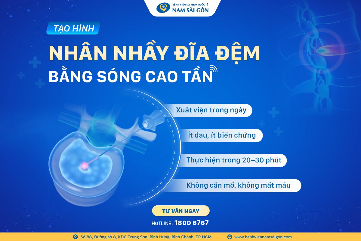 TẠO HÌNH NHÂN NHẦY ĐĨA ĐỆM BẰNG SÓNG CAO TẦN – GIẢI PHÁP KHÔNG PHẪU THUẬT CHO THOÁT VỊ ĐĨA ĐỆM