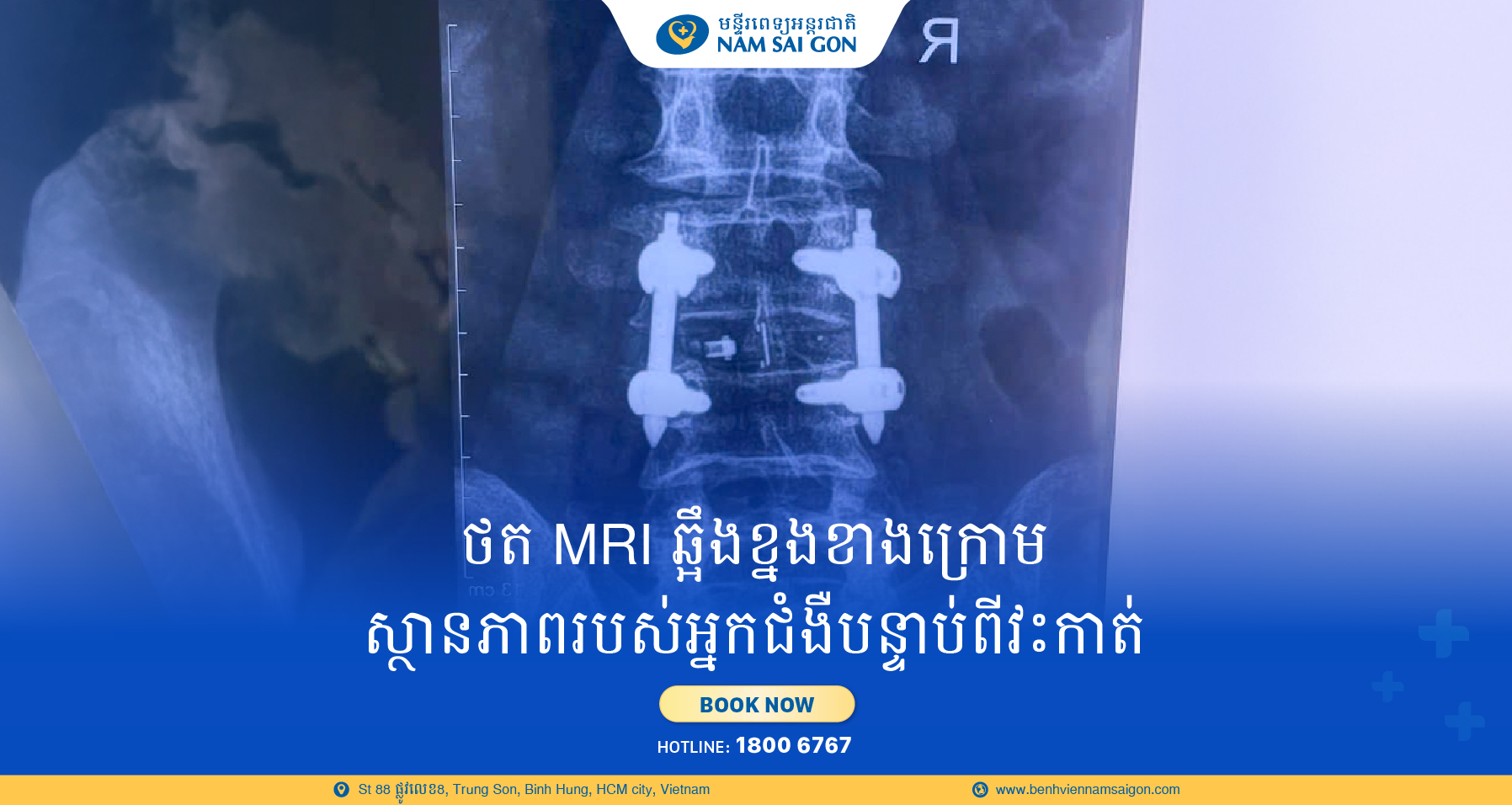 Bai 1 KHMER Banner 2