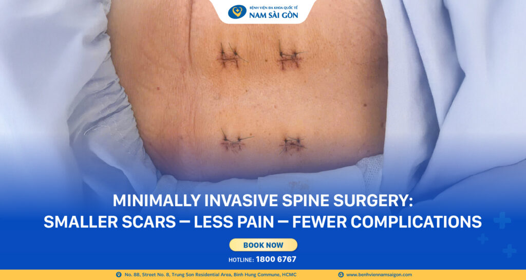 ENDOSCOPIC TREATMENT OF HERNIATED DISC: 74-YEAR-OLD MAN WALKS AGAIN AFTER 48 HOURS 6 Banner 3