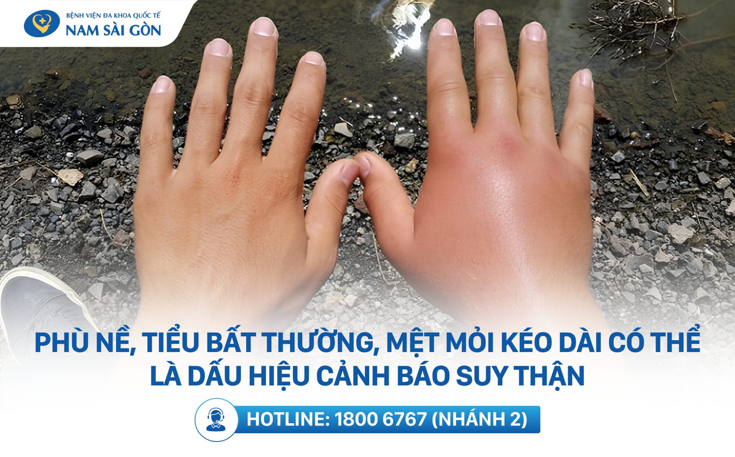 dau-hieu-suy-than