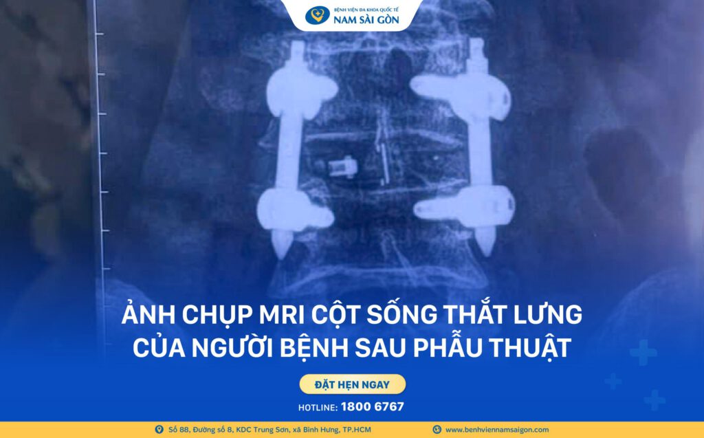 Website CU ONG 74 TUOI PHUC HOI VAN DONG SAU 48H 2