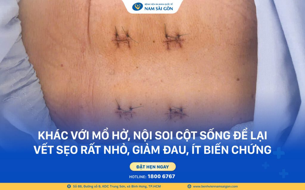 Website CU ONG 74 TUOI PHUC HOI VAN DONG SAU 48H 3
