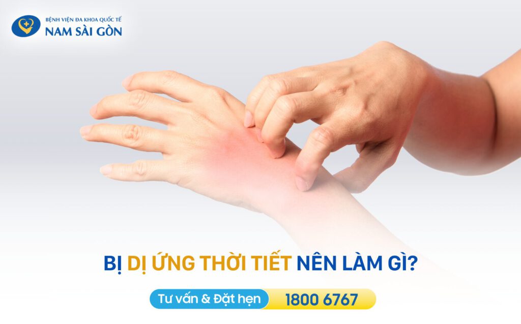 bị dị ứng thời tiết phải làm sao bị dị ứng thời tiết nên làm gì