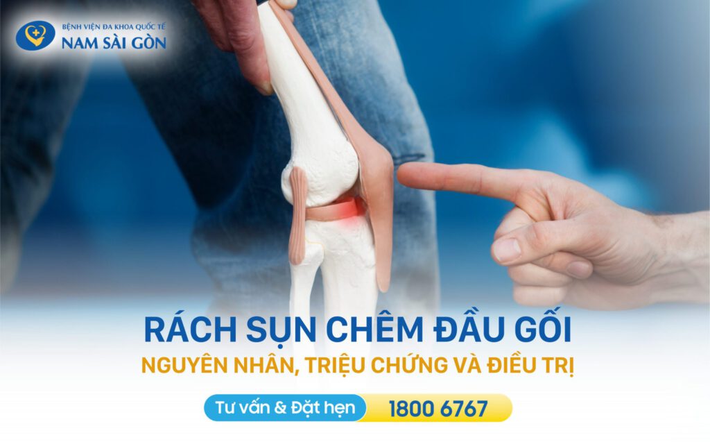 rách sụn chêm đầu gối 