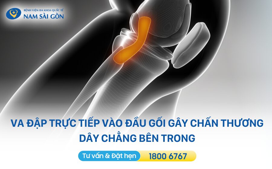chan-thuong-gay-dut-day-chang-dau-goi