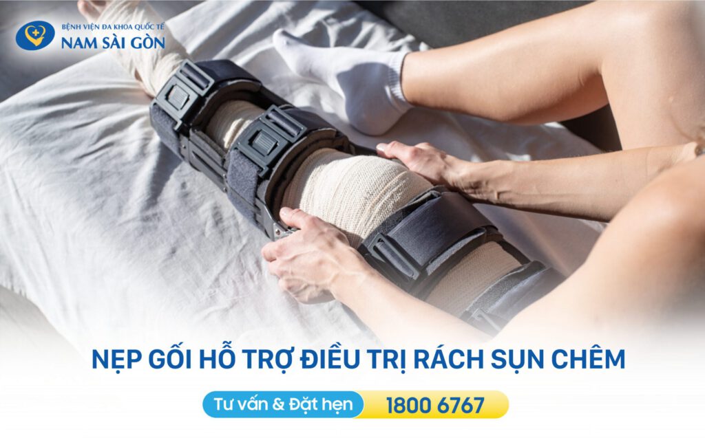 nẹp gối là một phương pháp điều trị bảo tồn chấn thương rách sụn chêm