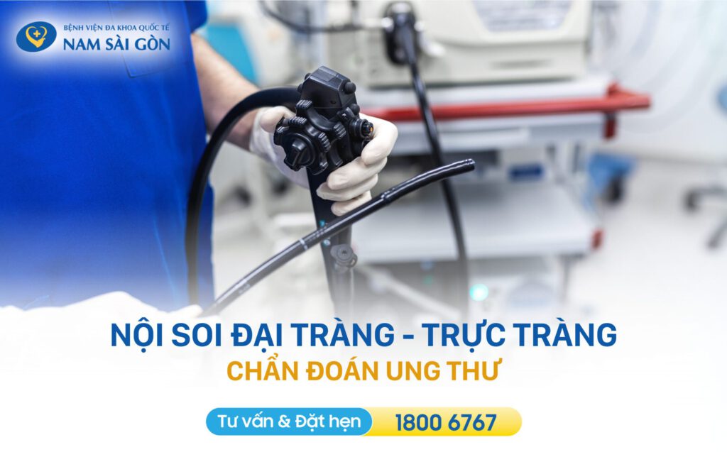 Chẩn đoán ung thư đại tràng