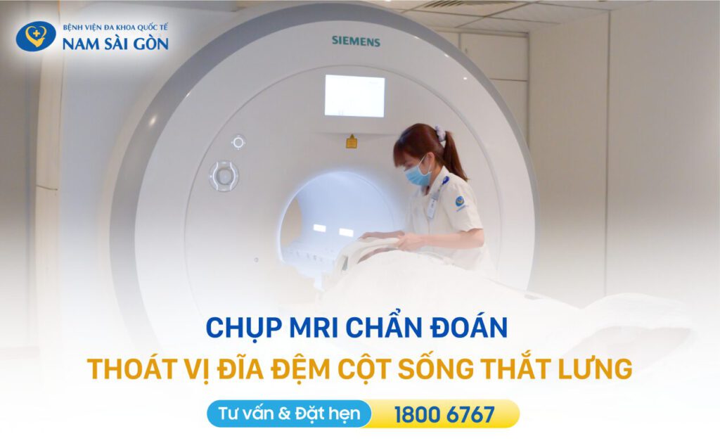 chan-doan-thoat-vi-dia-dem-cot-song-that-lung