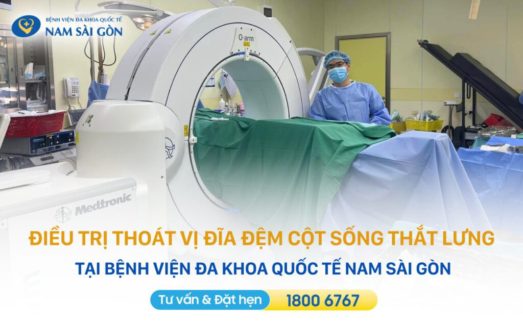 dieu-tri-thoat-vi-dia-dem-cot-song-that-lung