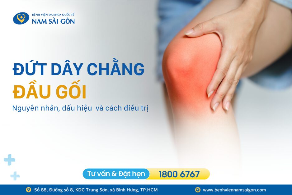 ĐỨT DÂY CHẰNG ĐẦU GỐI: NGUYÊN NHÂN, TRIỆU CHỨNG VÀ CÁCH ĐIỀU TRỊ