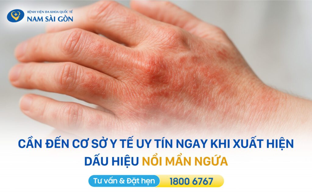 BI QUYET SU DUNG THUOC AN TOAN 4
