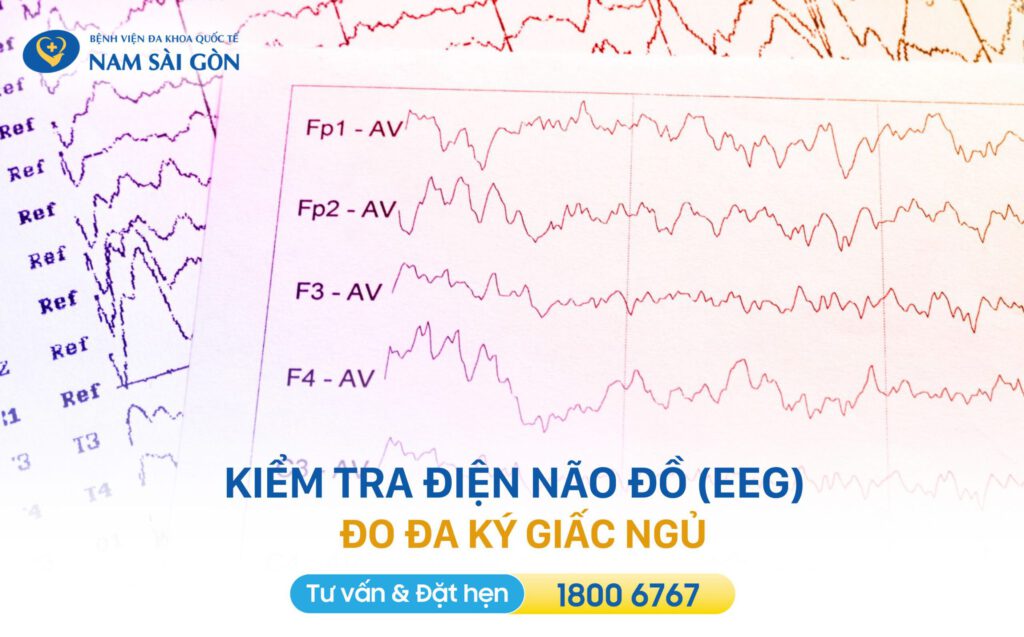 đo đa ký giấc ngủ qua điện não đồ 