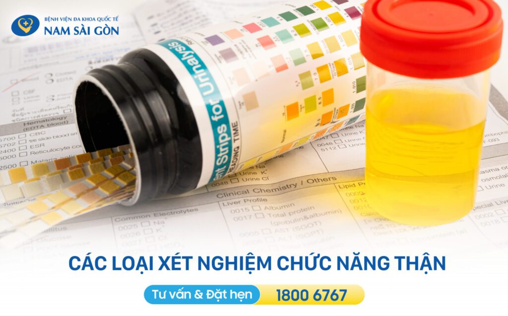 các loại xét nghiệm chức năng thận