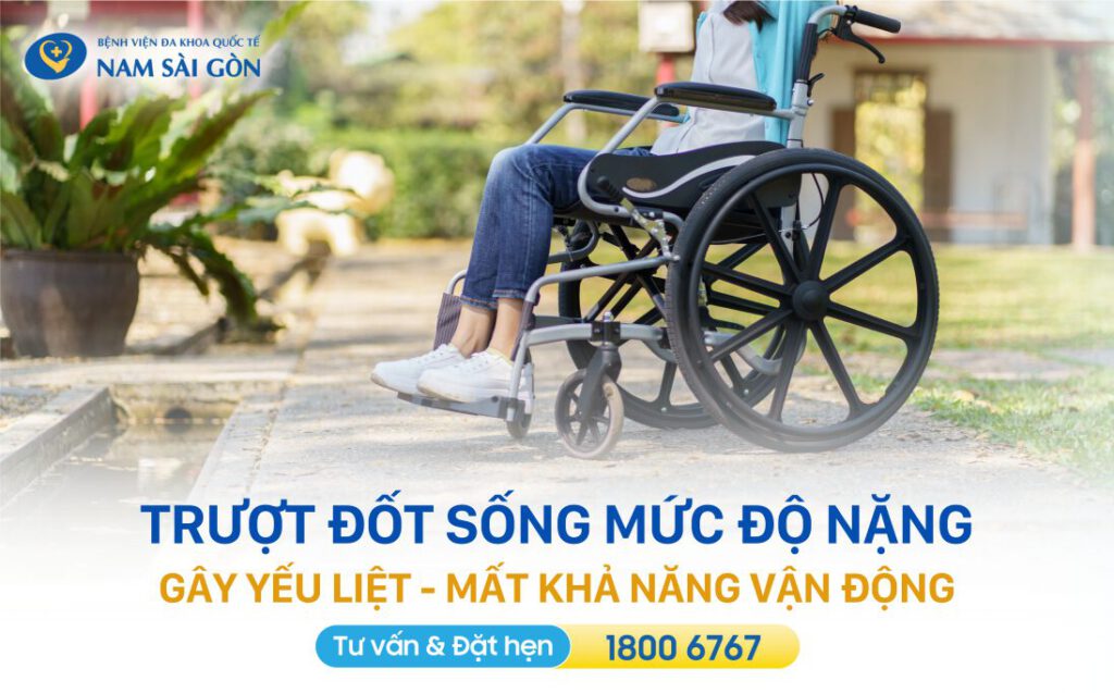 dấu hiệu và biến chứng của trượt đốt sống lưng