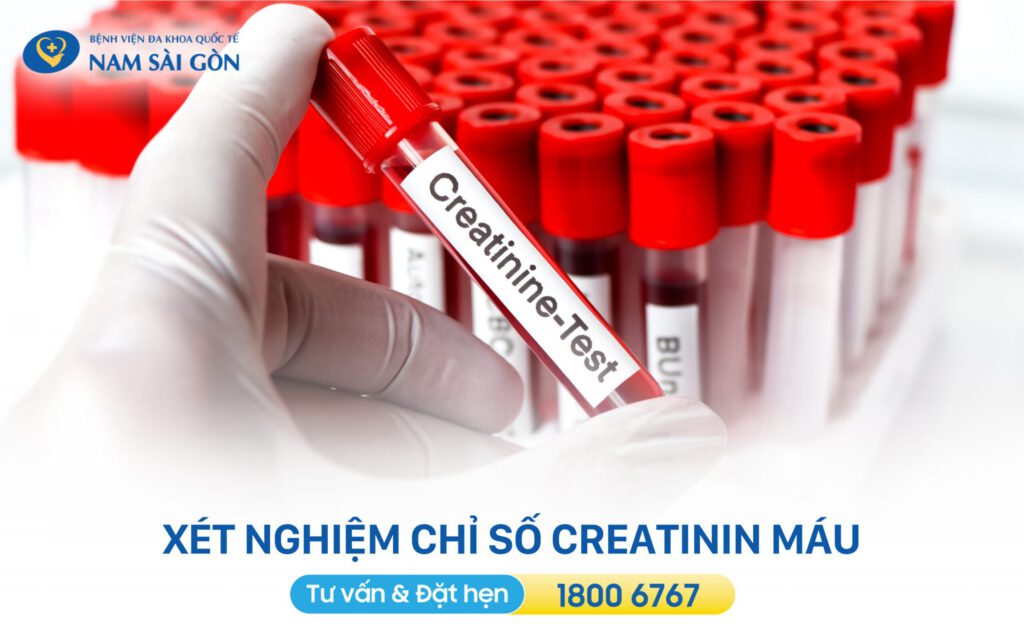 xét nghiệm máu trong kiểm tra thận