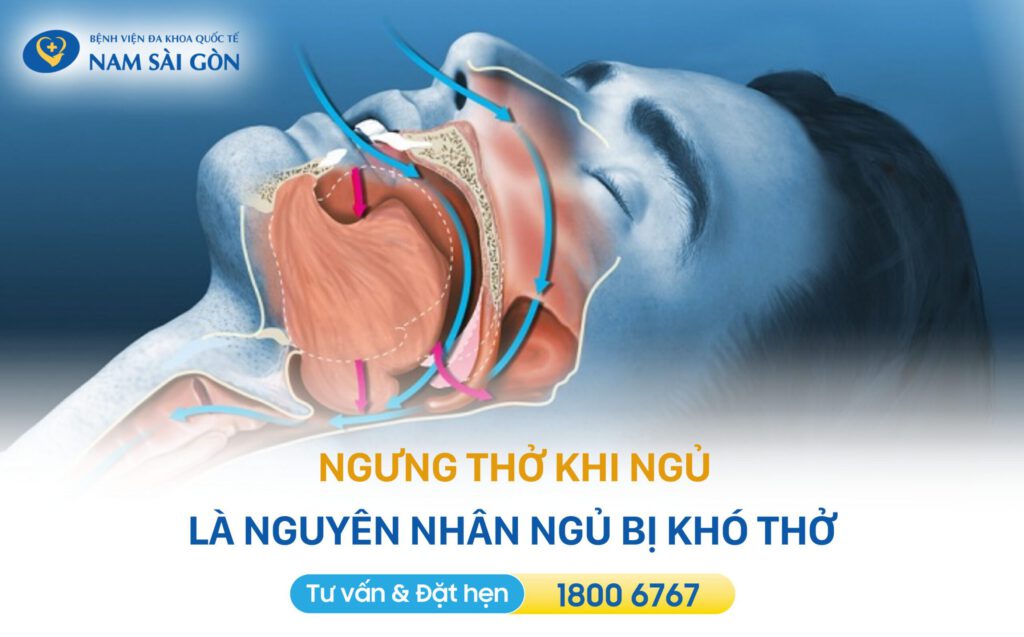 Nguyên nhân ngủ bị khó thở