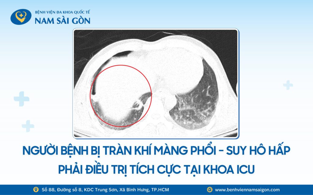 Web H3 Ca benh SUYT MAT CANH TAY SAU TAI NAN NAM THANH NIEN 26 TUOI HOI PHUC NGOAN MUC