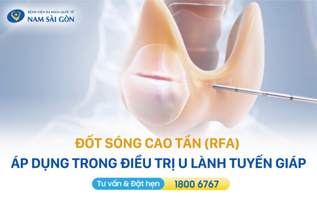 ĐỐT SÓNG CAO TẦN (RFA): KỸ THUẬT ĐIỀU TRỊ U LÀNH KHÔNG ĐAU, THẨM MỸ 13 DOT SONG CAO TAN RFA 3