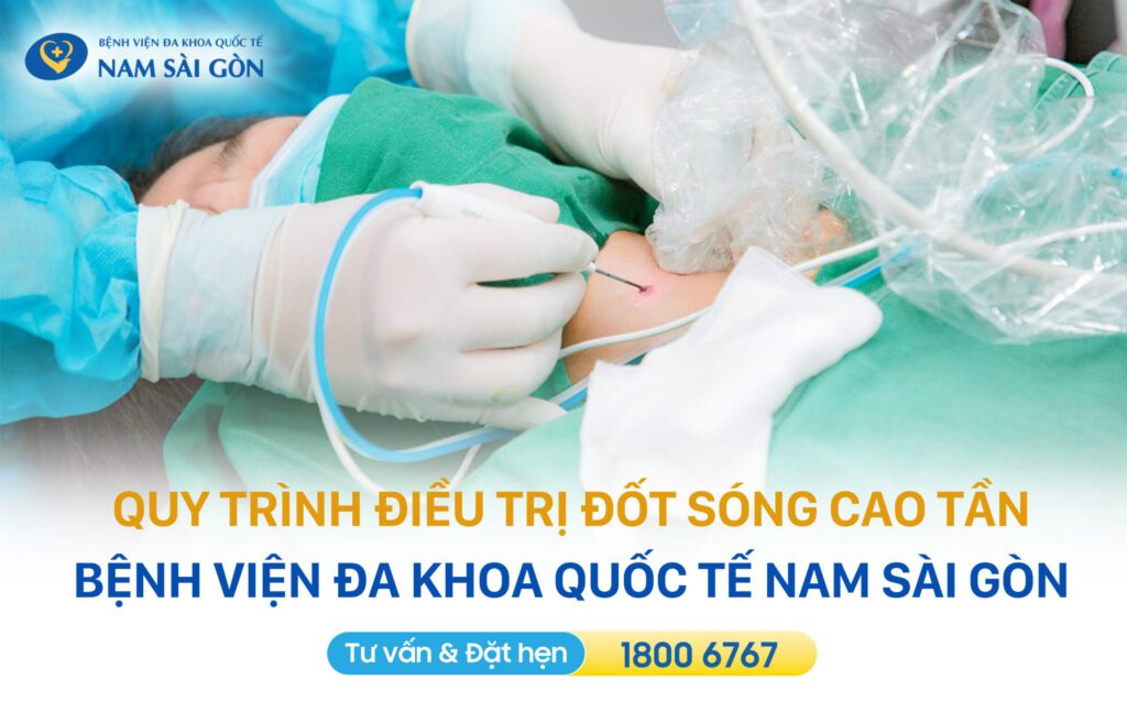 ĐỐT SÓNG CAO TẦN (RFA): KỸ THUẬT ĐIỀU TRỊ U LÀNH KHÔNG ĐAU, THẨM MỸ 16 DOT SONG CAO TAN RFA 6