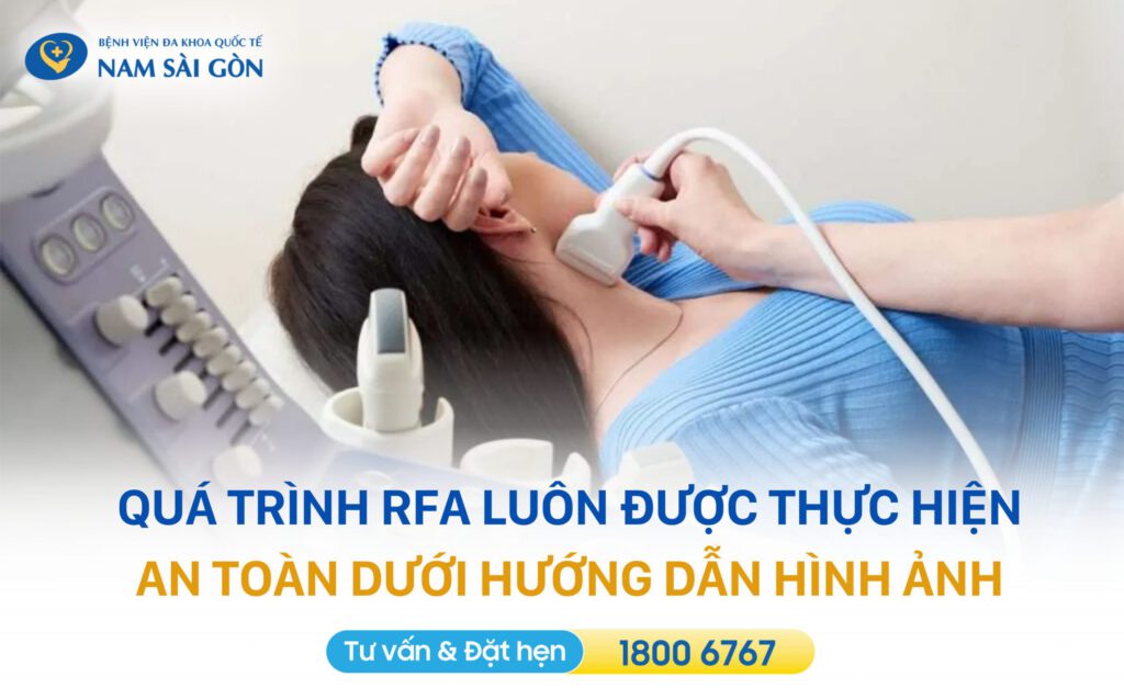 ĐỐT SÓNG CAO TẦN (RFA): KỸ THUẬT ĐIỀU TRỊ U LÀNH KHÔNG ĐAU, THẨM MỸ 17 DOT SONG CAO TAN RFA 7
