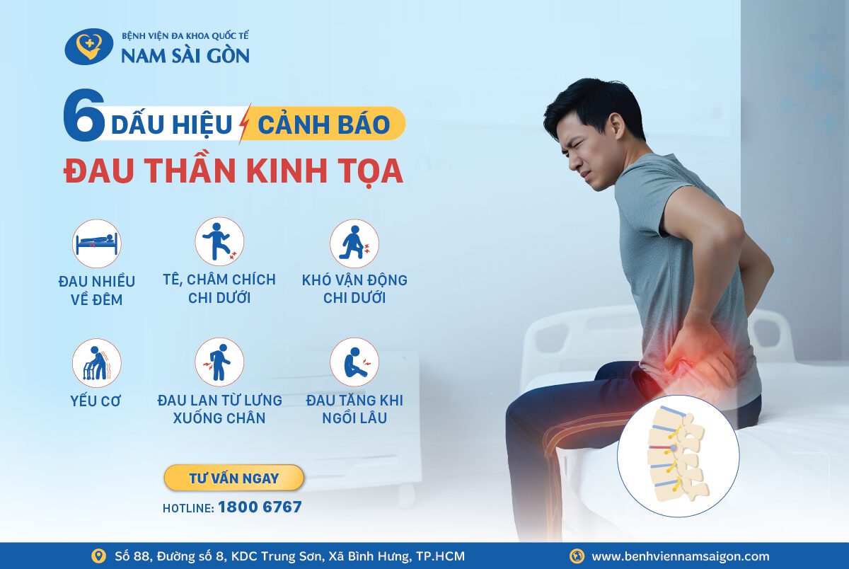 ĐAU THẦN KINH TỌA – 6 DẤU HIỆU CẢNH BÁO KHÔNG NÊN BỎ QUA