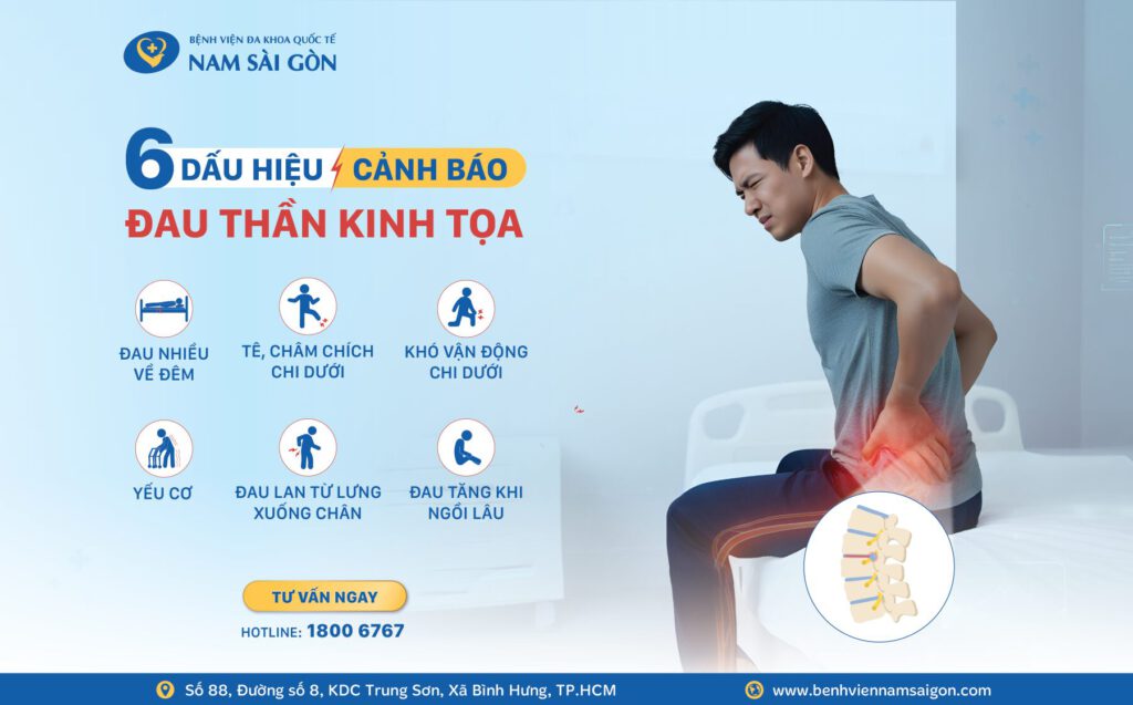 ĐAU THẦN KINH TỌA - 6 DẤU HIỆU CẢNH BÁO KHÔNG NÊN BỎ QUA 2 WEBSITE Dau day than kinh toa