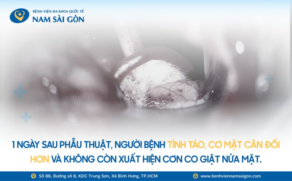 HÀNH TRÌNH TÌM LẠI NỤ CƯỜI SAU HƠN 1 NĂM BỊ CO GIẬT NỬA MẶT 7 Web H2 Ca benh NAM THANH NIEN SONG CUNG 2 KHOI U KHONG LO TREN MAT SUOT 10 NAM copy