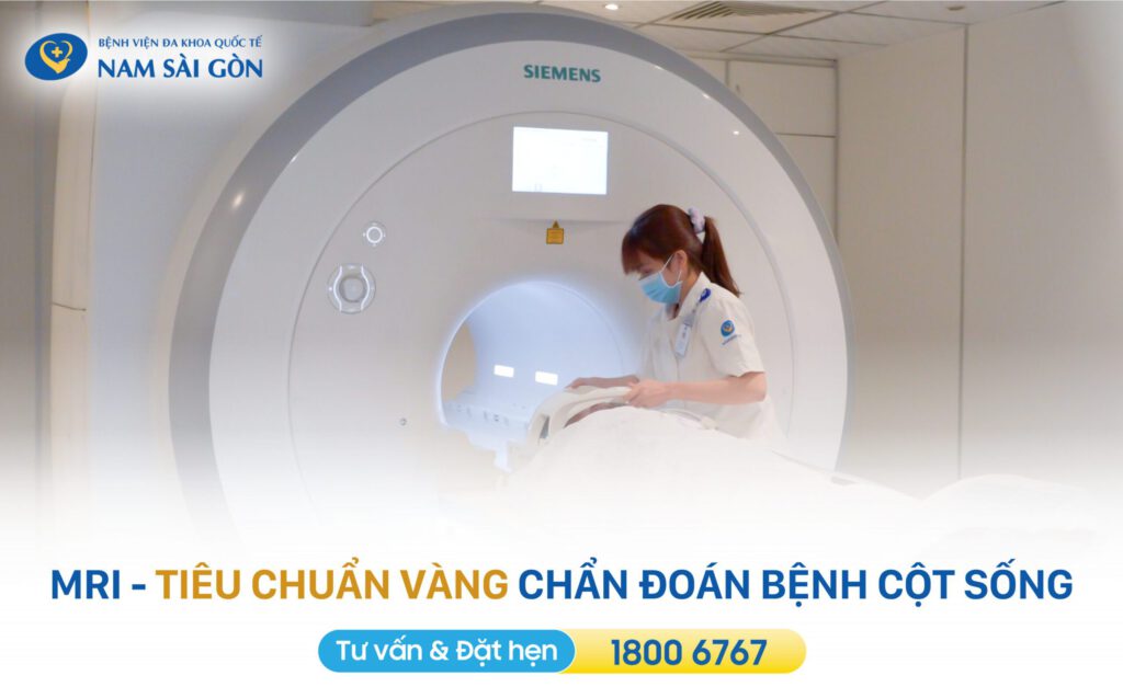 chẩn đoán đau thần kinh tọa