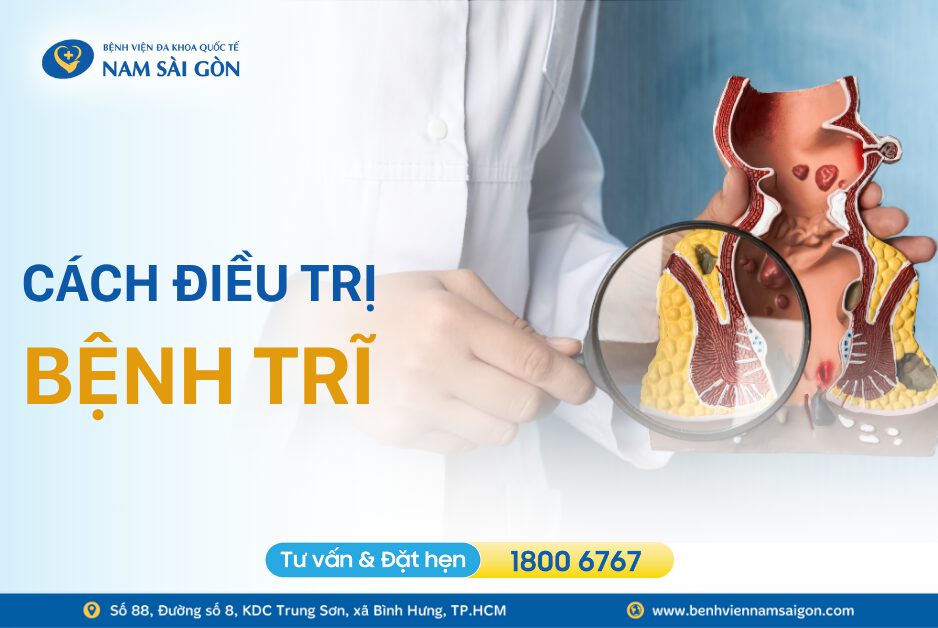NHỮNG CÁCH ĐIỀU TRỊ BỆNH TRĨ HIỆU QUẢ VÀ PHỔ BIẾN HIỆN NAY