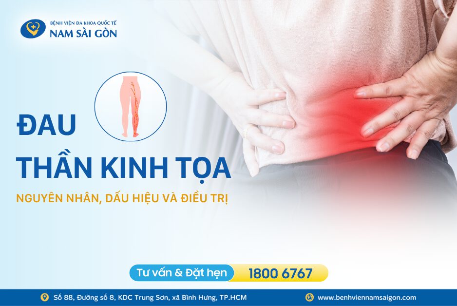 ĐAU THẦN KINH TỌA – NGUYÊN NHÂN DẤU HIỆU VÀ CÁCH ĐIỀU TRỊ
