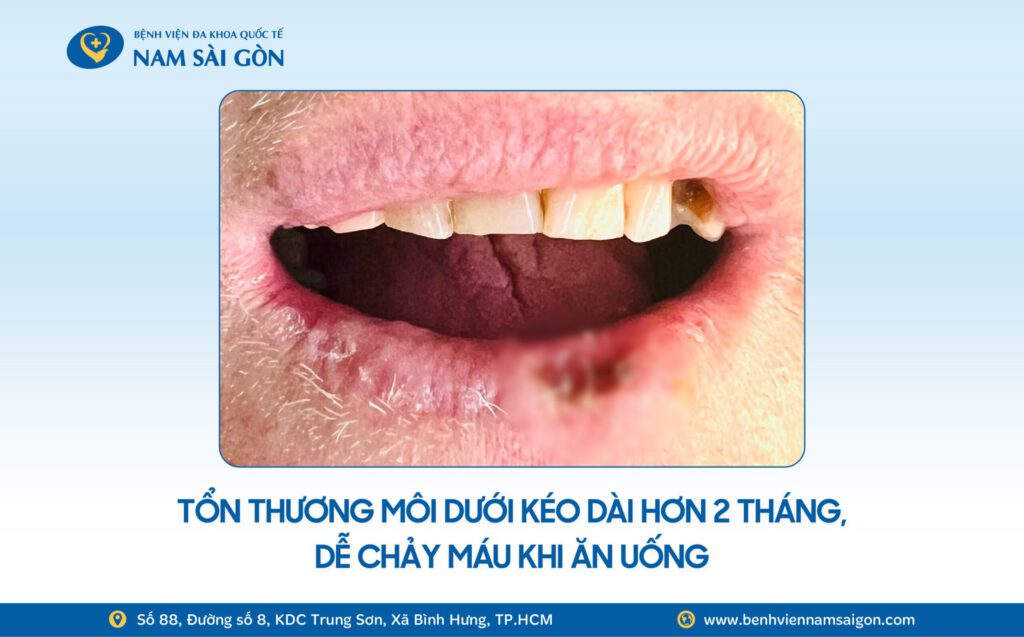 2025 12 02 Website H2 Ca benh TIM LAI KHUU GIAC SAU CA PHAU THUAT 2 TRONG 1