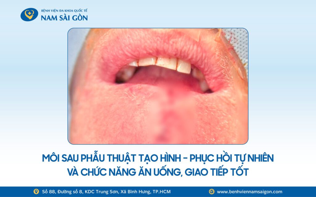 2025 12 02 Website H3 Ca benh TIM LAI KHUU GIAC SAU CA PHAU THUAT 2 TRONG 1