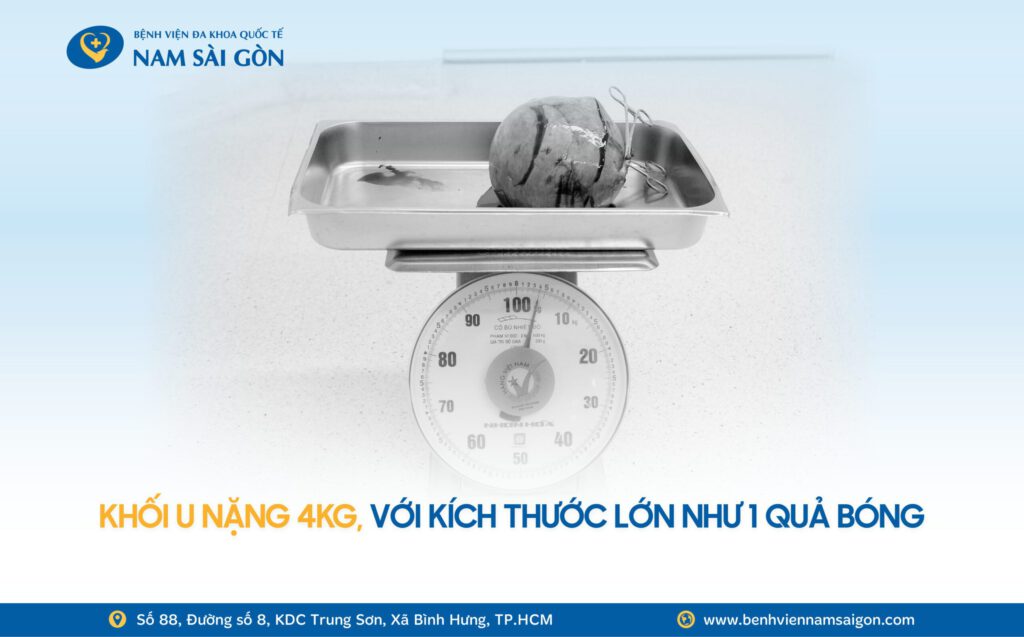 2026 01 07 Ca benh Website H4 PHAU THUAT CAT TU CUNG VI KHOI U XO KHONG LO NANG HON 4KG