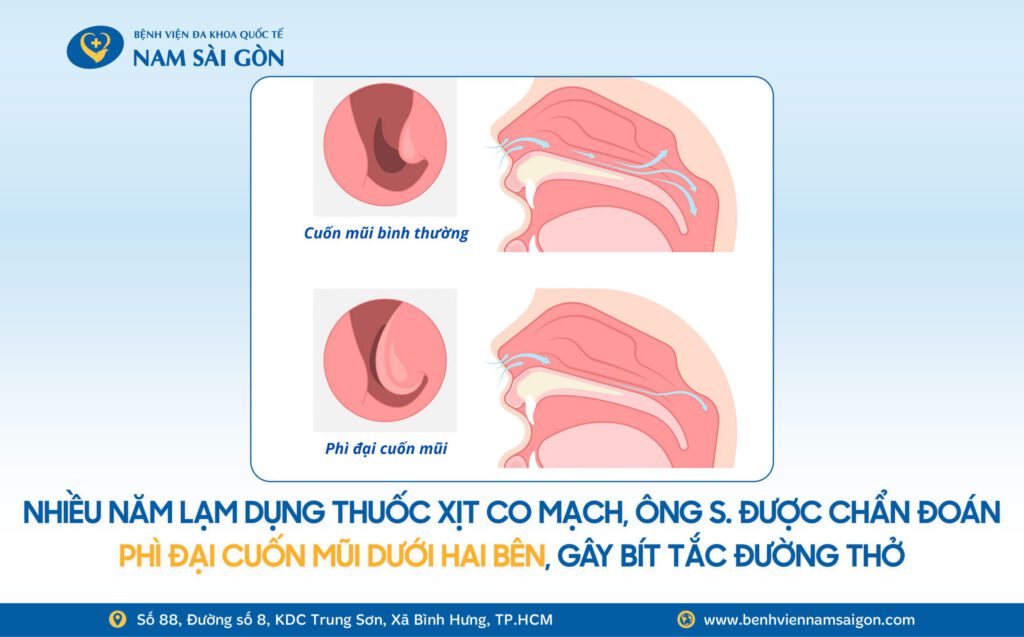 2026 01 20 Wbs H2 Ca Benh GIAI PHONG DUONG THO NGUOI DAN ONG NGHET MUI 5 NAM LE THUOC THUOC CO MACH