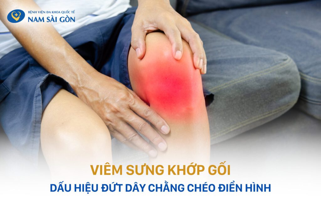 dấu hiệu đứt dây chằng