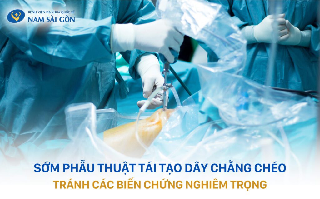 nội soi tái tạo dây chằng 