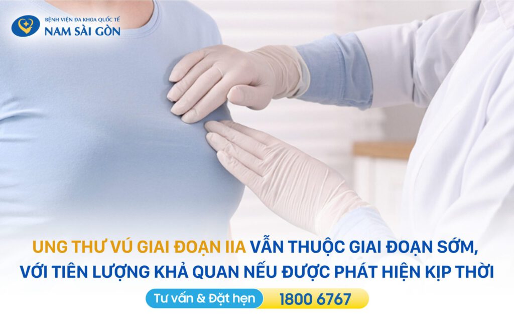 UNG THƯ VÚ GIAI ĐOẠN ĐẦU - CÁC GIAI ĐOẠN, BIỂU HIỆN VÀ ĐIỀU TRỊ 4 Ung thư vú giai đoạn IIA