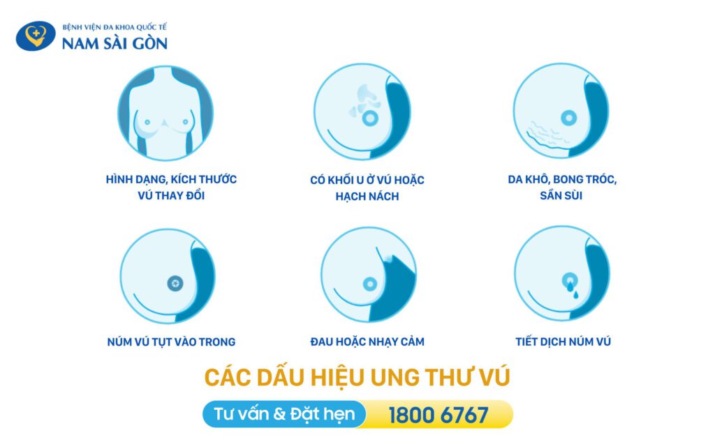 UNG THƯ VÚ GIAI ĐOẠN ĐẦU - CÁC GIAI ĐOẠN, BIỂU HIỆN VÀ ĐIỀU TRỊ 5 biểu hiện ung thư vú giai đoạn đầu