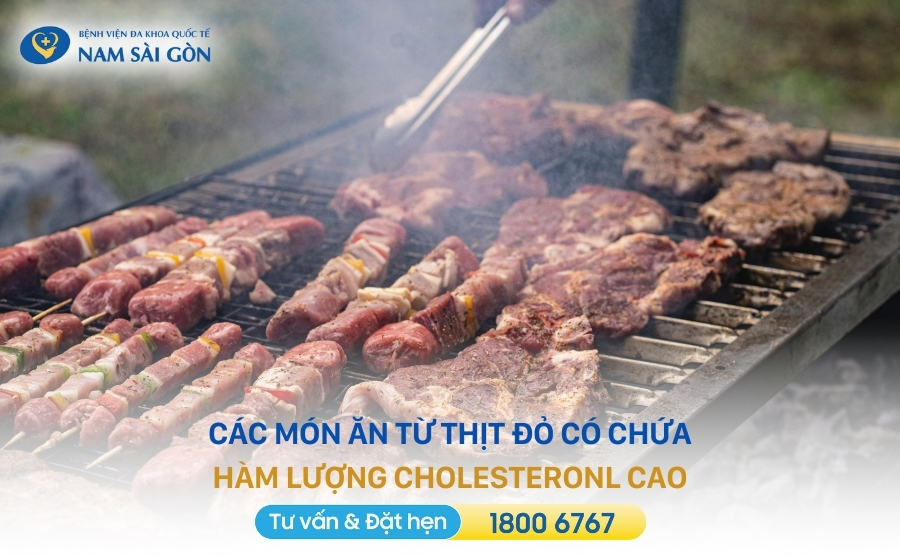 mỡ máu cao kiêng ăn gì