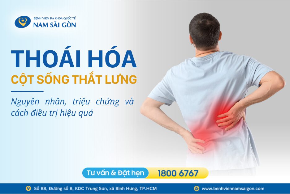 THOÁI HOÁ CỘT SỐNG THẮT LƯNG – NGUYÊN NHÂN, DẤU HIỆU, CÁCH ĐIỀU TRỊ