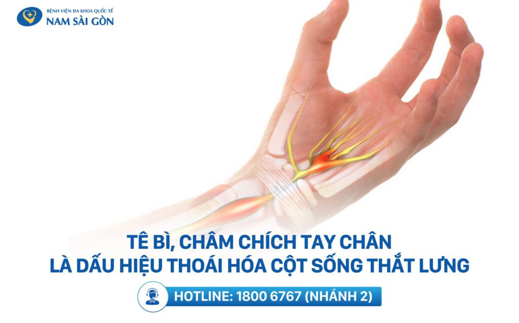 Triệu chứng thoái hóa đốt sống thắt lưng