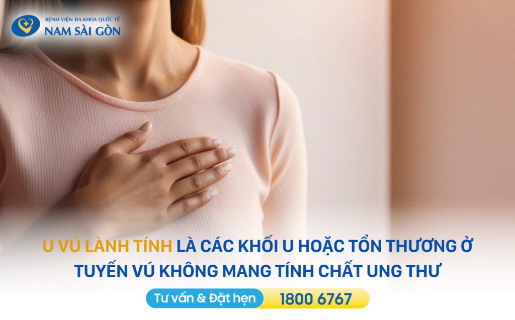 u vú lành tính là gì