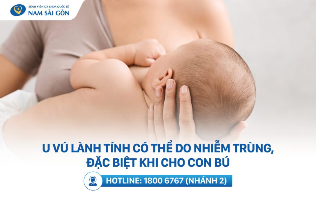 Nguyên nhân u vú lành tính