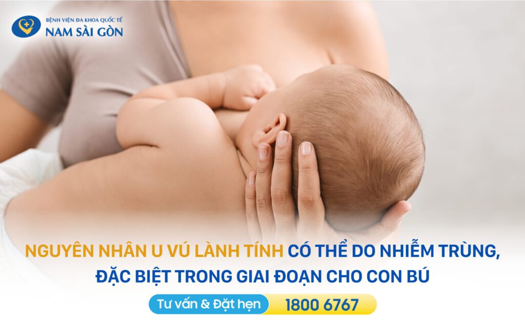 u vú lành tính có chuyển thành ác tính không