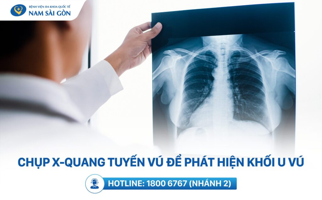 u vú lành tính có chuyển thành ác tính không
