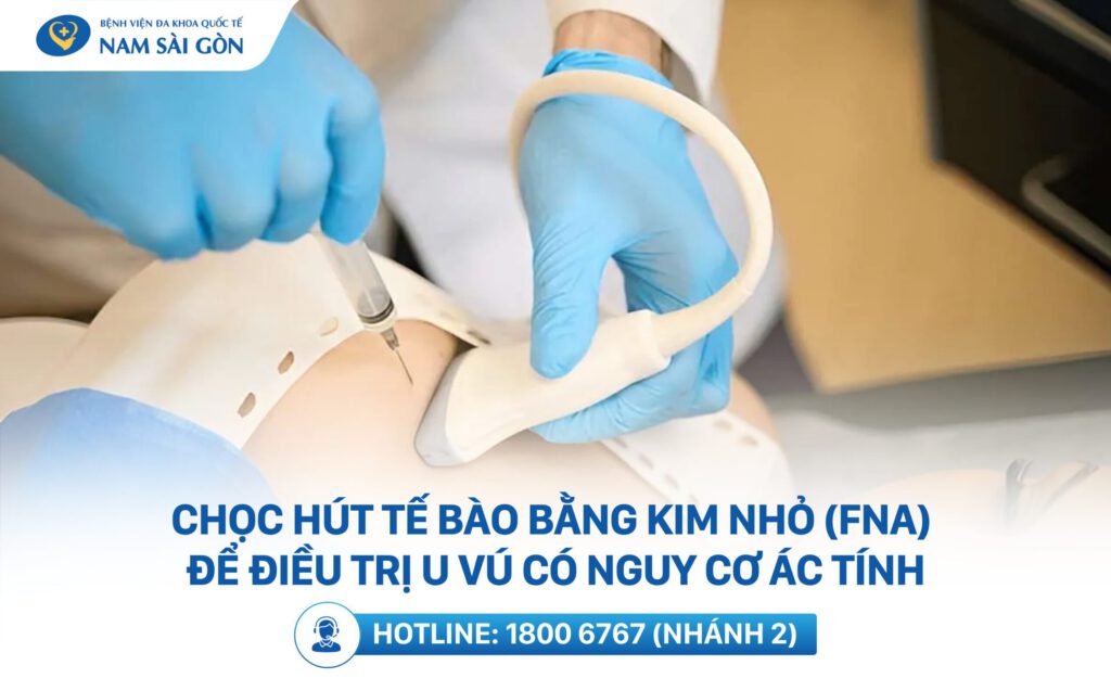 Điều trị khối u tuyến vú lành tính