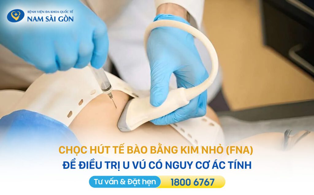 u vú lành tính có nên mổ không