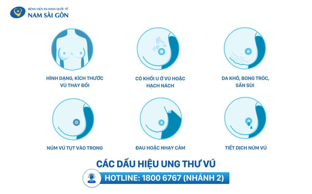 ung thư vú giai đoạn đầu có biểu hiện gì