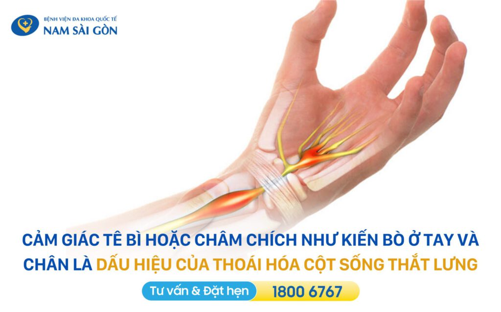 thoái hóa đốt sống lưng l4 l5